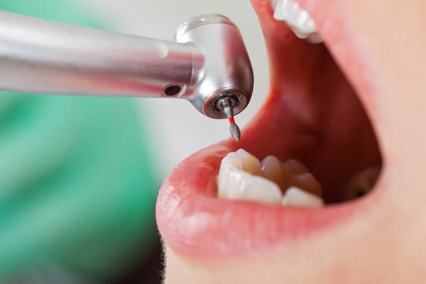 Best Cracked Tooth Emergency Dentist  in Edgerton, KS